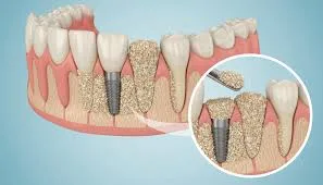 Regenerative membrane product